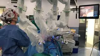 El Peset realiza su primera cirugía robótica con un equipo da Vinci