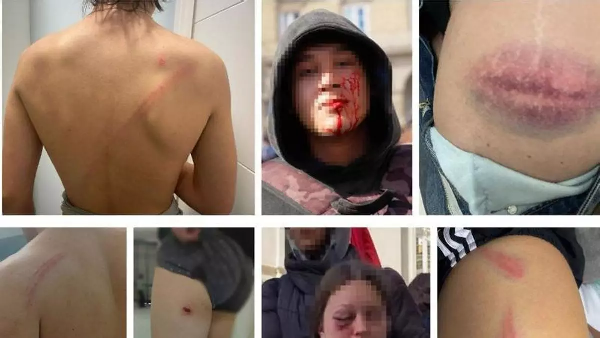 Jóvenes heridos en A Coruña denuncian cargas policiales desproporcionadas tras la protesta contra Vox