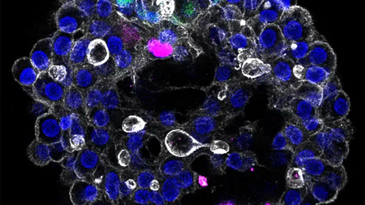 El modelo incluye los tres tipos de células clave del hígado: fibroblastos portales (magenta), colangiocitos (verde) y núcleos de hepatocitos (azul).