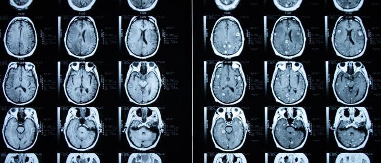 Imagen de archivo de una tomografía cerebral