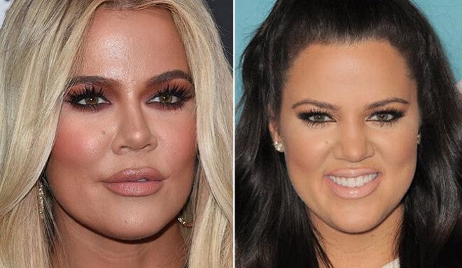 Antes y después de Khloé Kardashian