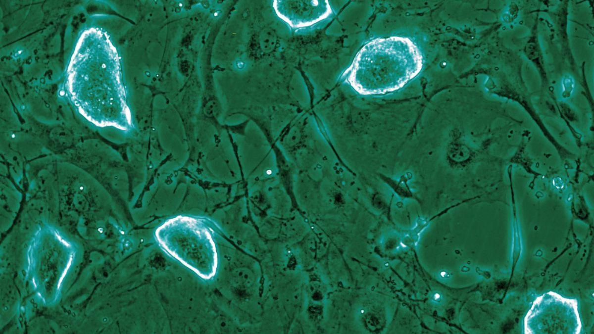 Buscan explicar cómo las células embrionarias entran en “animación suspendida” y qué papel tendría ese proceso en el desarrollo del cáncer.