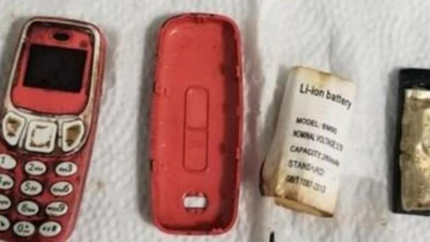 Las tres partes en que fue extraído el móvil del cuerpo del paciente, con la batería ya separada.