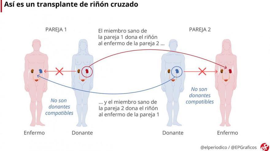 Tres hospitales culminan una cadena de tres trasplantes cruzados de riñón