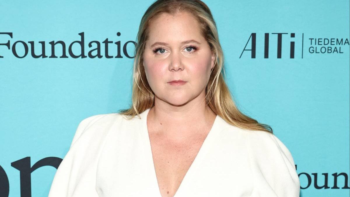 Así vive Amy Schumer su vida con síndrome de Cushing