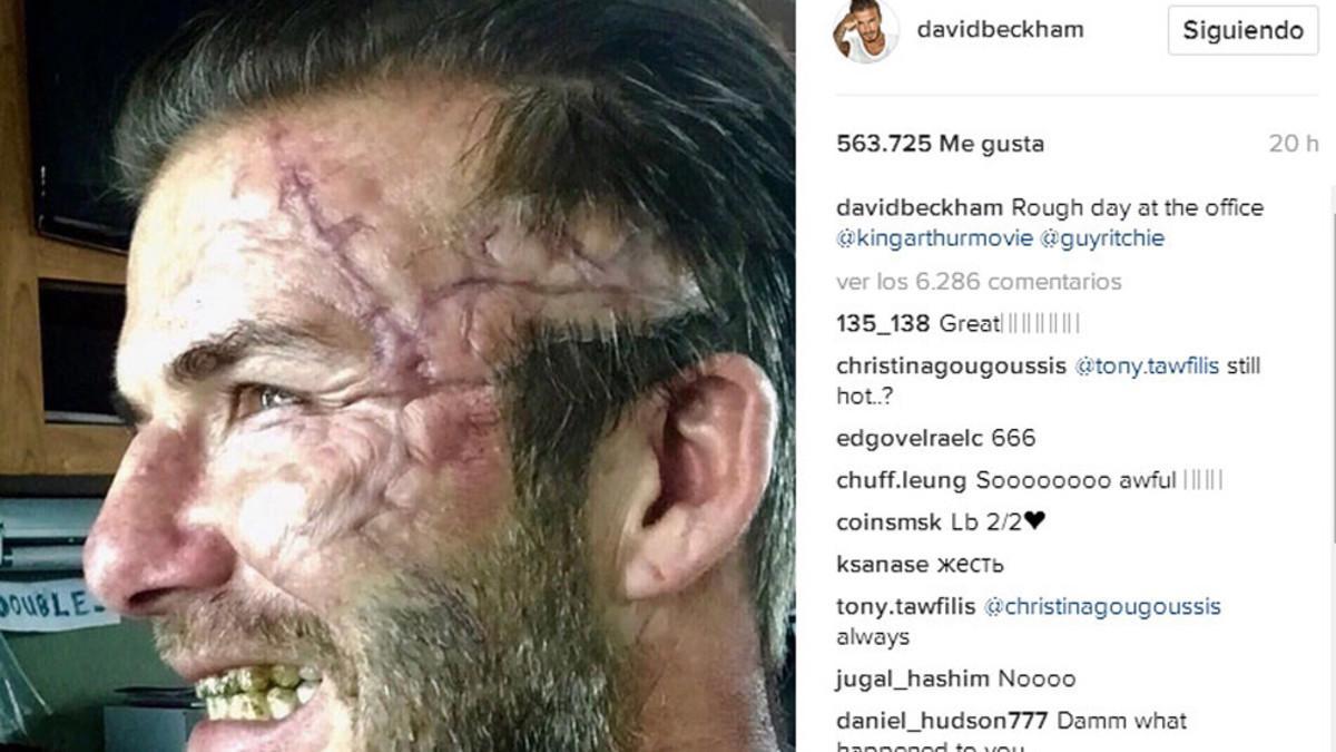 Beckham sufrió cambios en su rostro para interpretar su personaje