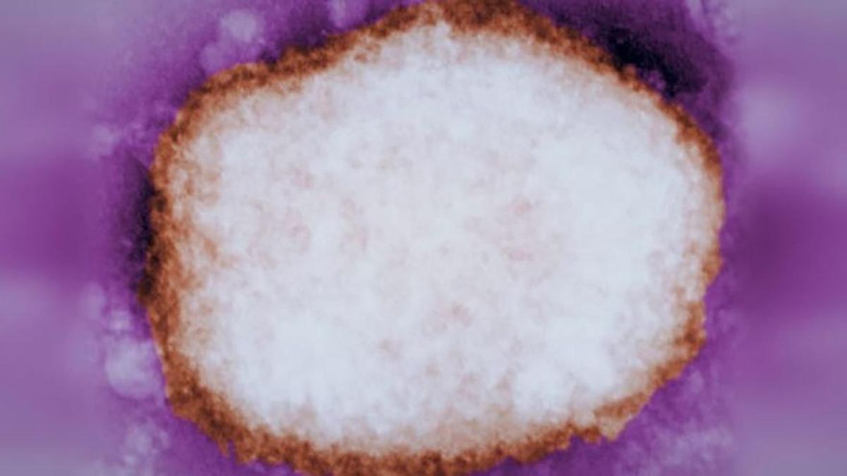 Imagen microscópica del virus que provoca de la viruela del mono.