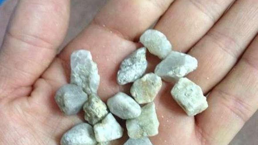 Un jugador muestra algunas de las piedras halladas en el césped.