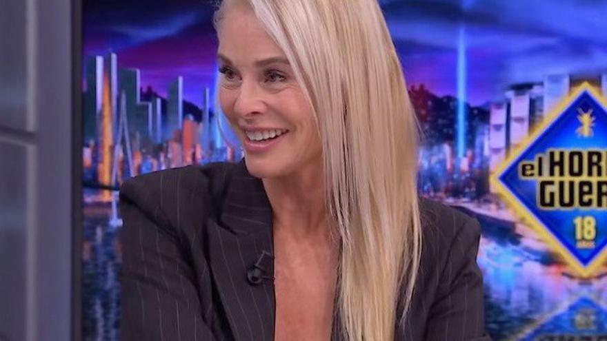 Belén Rueda habla en &#039;El Hormiguero&#039; del ictus que sufrió: &quot;Fue por estrés&quot;