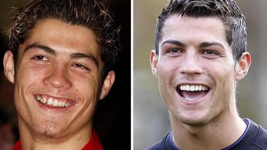 Cristiano no siempre fue guapo...