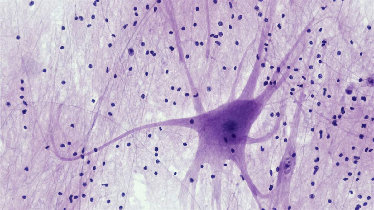 NEUROTECNOLOGÍA / Un microscopio en miniatura permite observar y controlar las neuronas mientras el cerebro está en movimiento