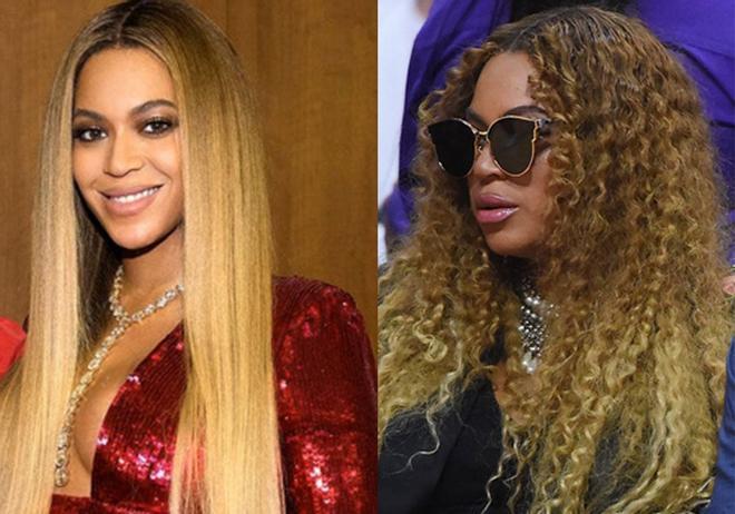 Beyoncé antes y después de tener los labios de Kylie Jenner
