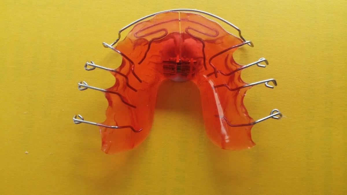 Los problemas dentales son habituales entre los niños que roncan.