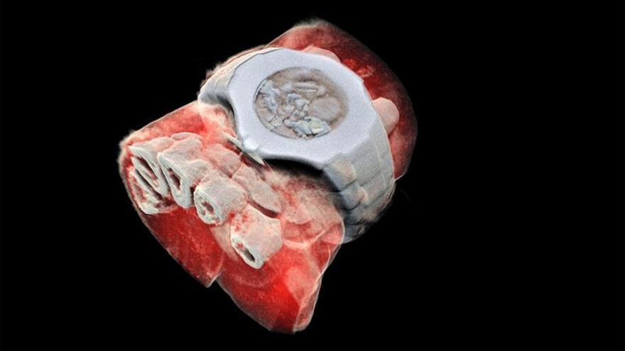 Investigadores neozelandeses crean radiografías 3D en color