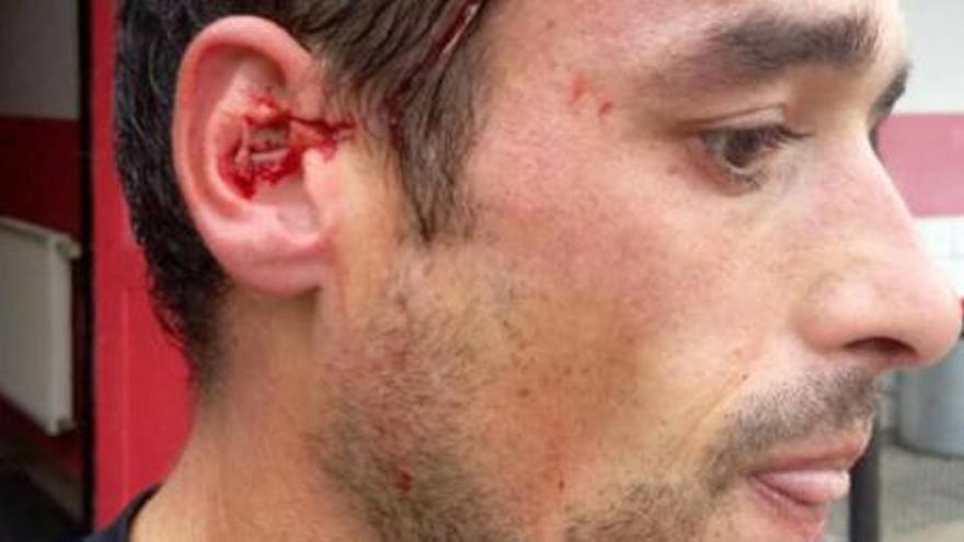 Brutal agresión al jugador español Alberto Mier en Alemania