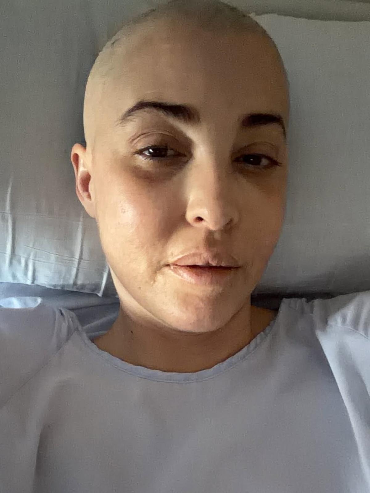 La imagen sin cabello compartida por B Jones.