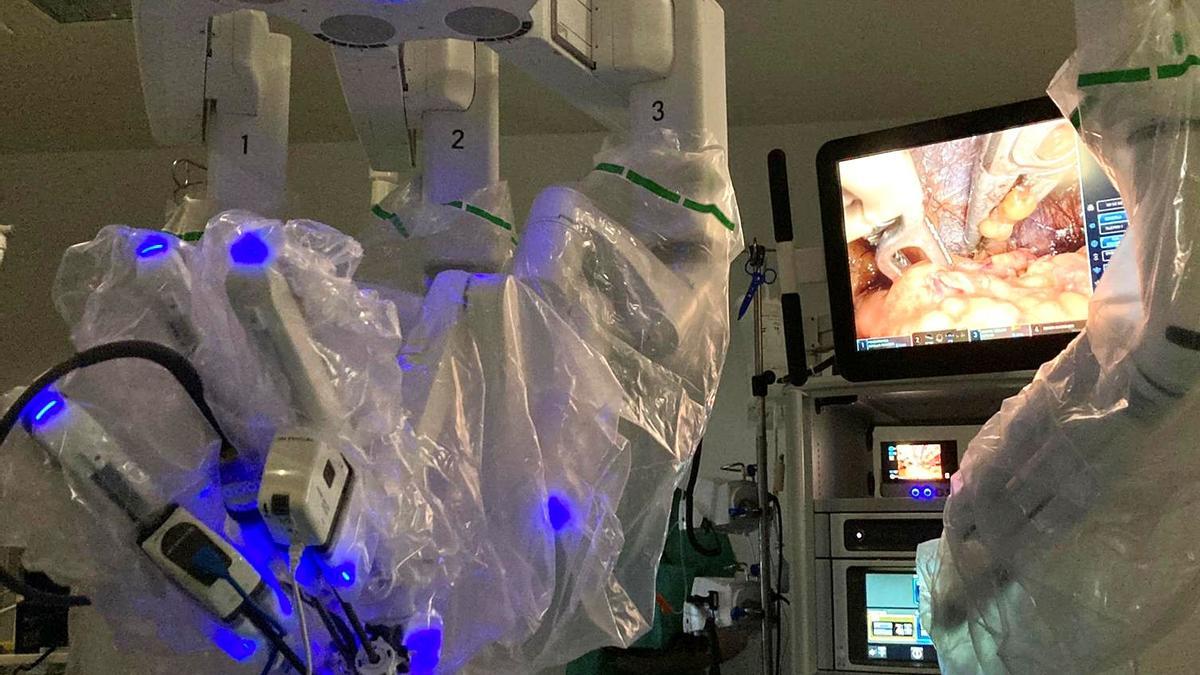 El robot Da Vinci, durante una cirugía renal por puerto único en el Hospital Universitario de A Coruña.