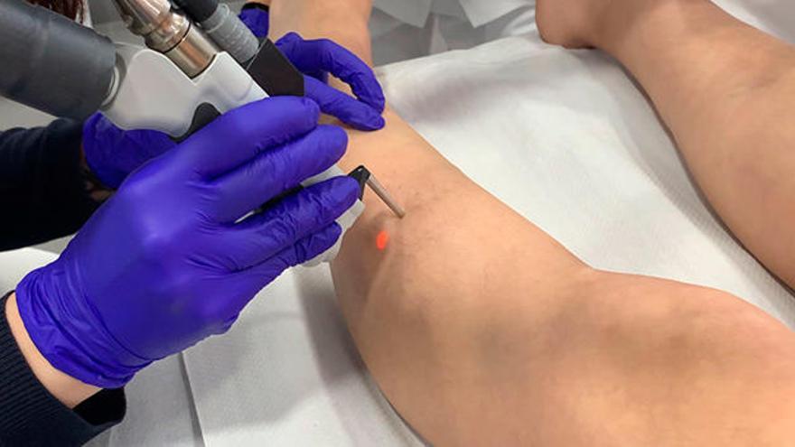 Piernas perfectas en cuatro pasos con Centro Dermatológico Estético