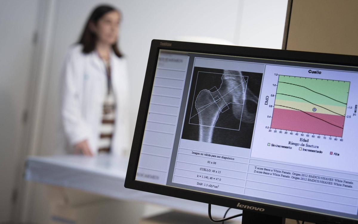 El 72% de dones amb osteoporosi no rep teràpia després d’una fractura