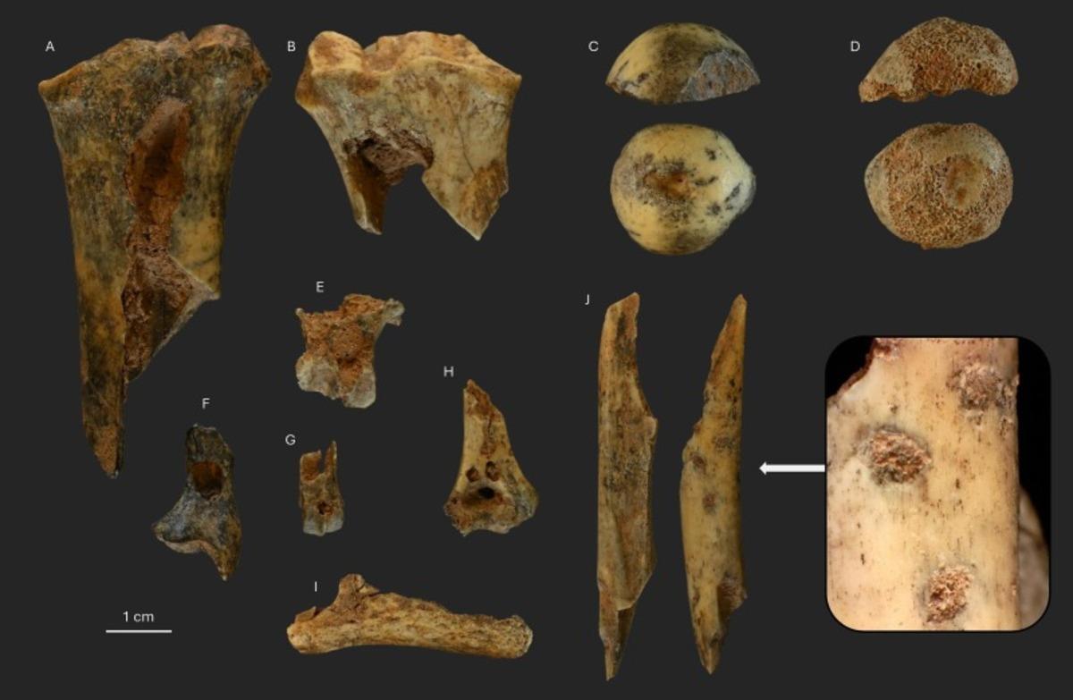 Restos óseos encontrados durante la investigación en Becerreá