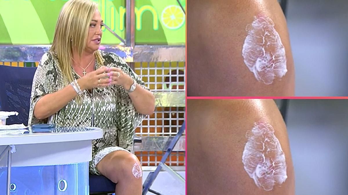 belen esteban legs Belén Esteban muestra las primeras imágenes de su rehabilitación - Sálvame