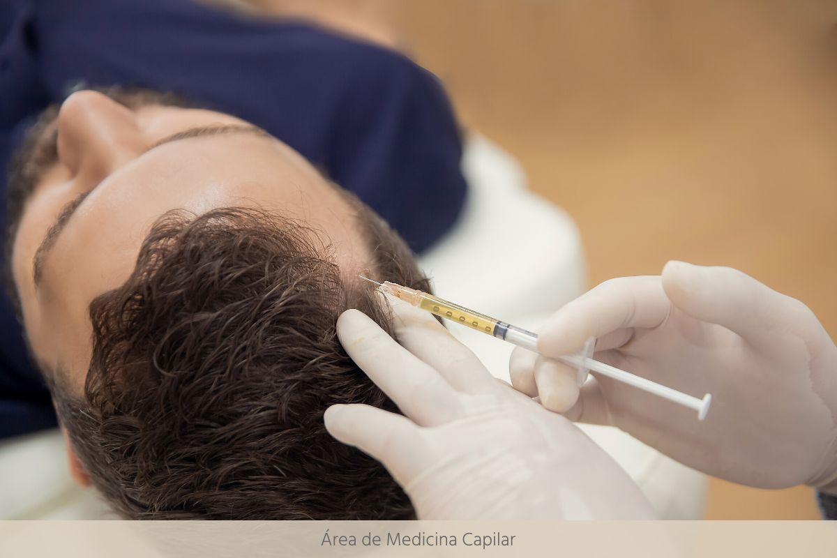 Área de Medicina Capilar