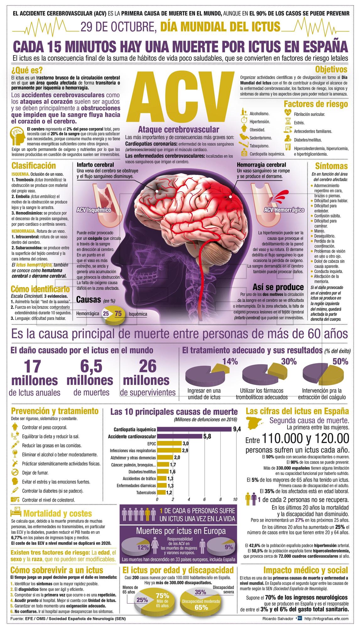 Infografía sobre el ictus o infarto cerebral