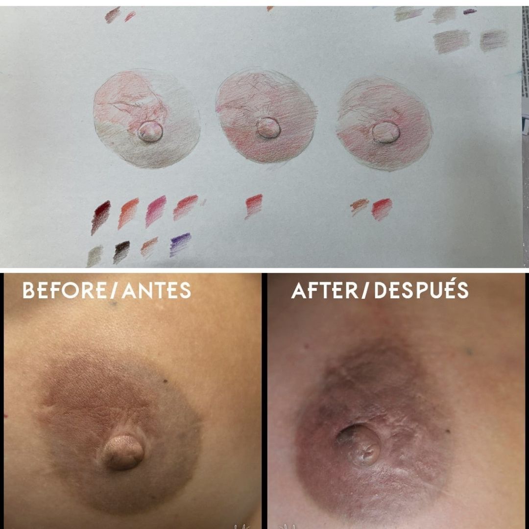 La mujer tenía parte de una de sus areolas descolorida, así que Miguel siguió el proceso habitual de probar colores y tonos para obtener el mejor resultado.