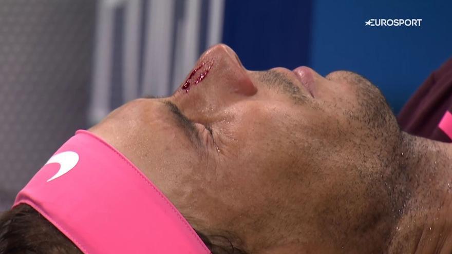 El duro partido de Rafa Nadal: ansiedad y sangre en la nariz