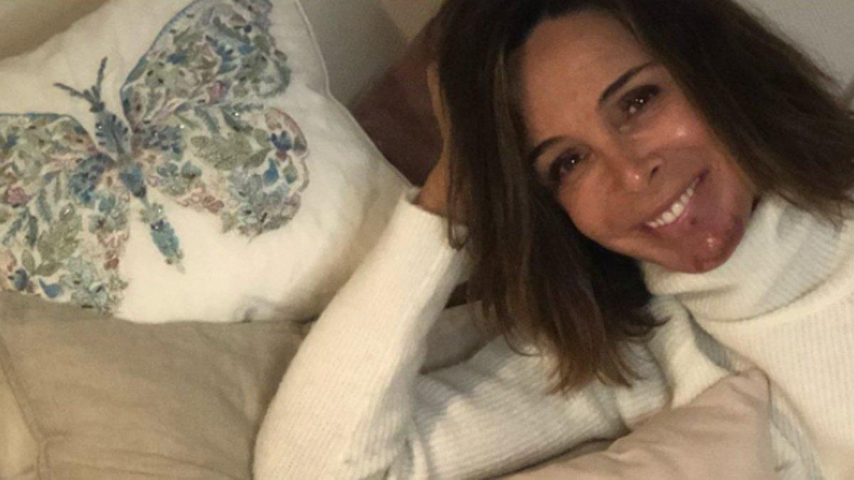 Lydia Bosch anuncia que tiene cáncer de piel