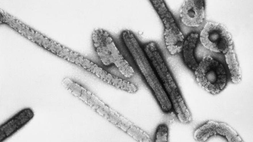 Sanidad elabora un protocolo para la detección y manejo de casos del virus de Marburgo