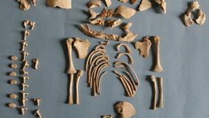 Parte del esqueleto de un niño con síndrome de Down de más de 2.500 años de antiguedad hallado en el yacimiento de Alto de la Cruz.