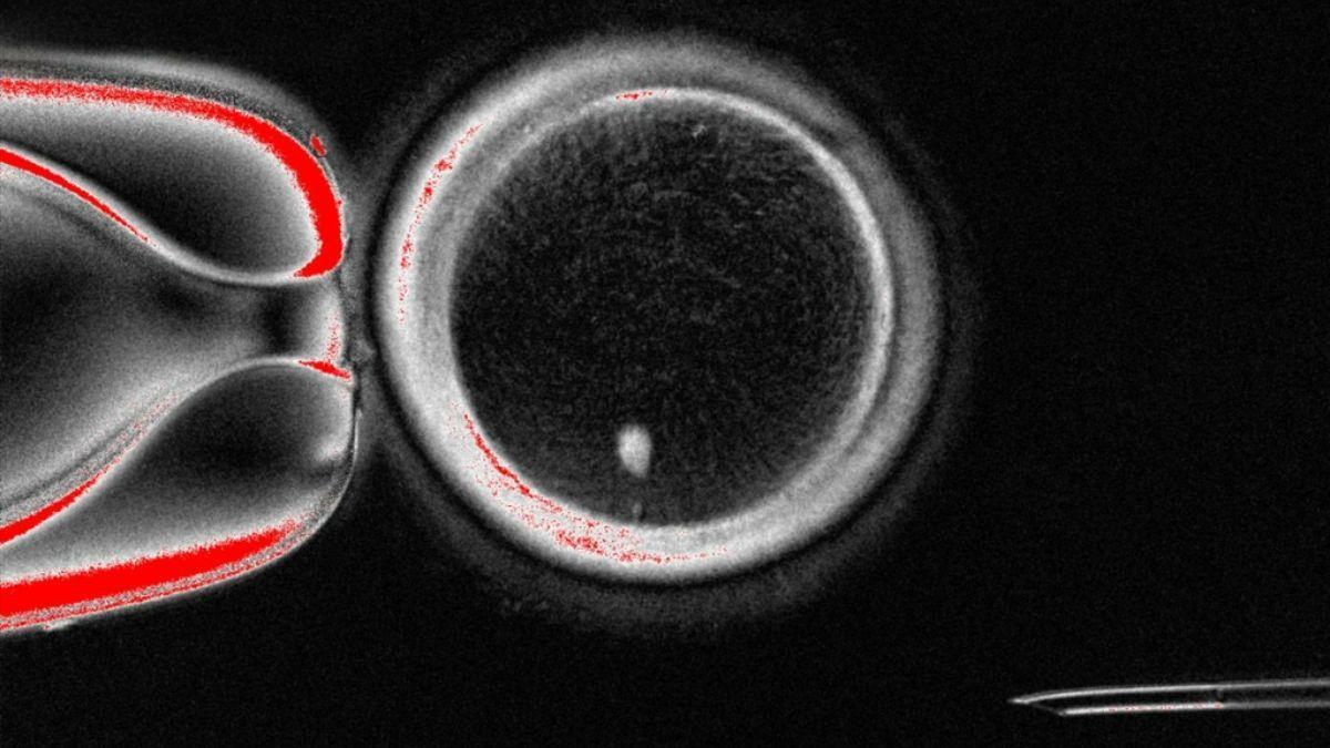 Los investigadores han demostrado una nueva técnica para tratar la infertilidad, convirtiendo las células de la piel en ovocitos u óvulos. Aquí se puede apreciar un ovocito, junto a la imagen brillante del núcleo de una célula de la piel antes de la fertilización.