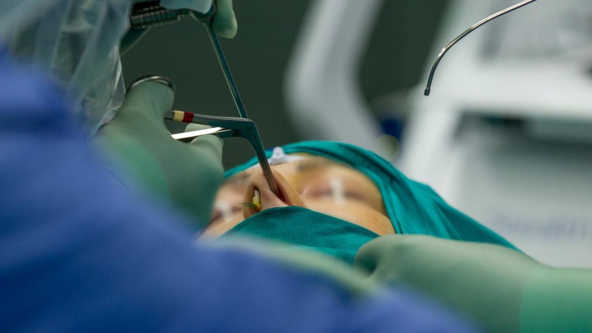 Imagen de una intervención a través de endoscopia nasal en el Hospital Doctor Balmis