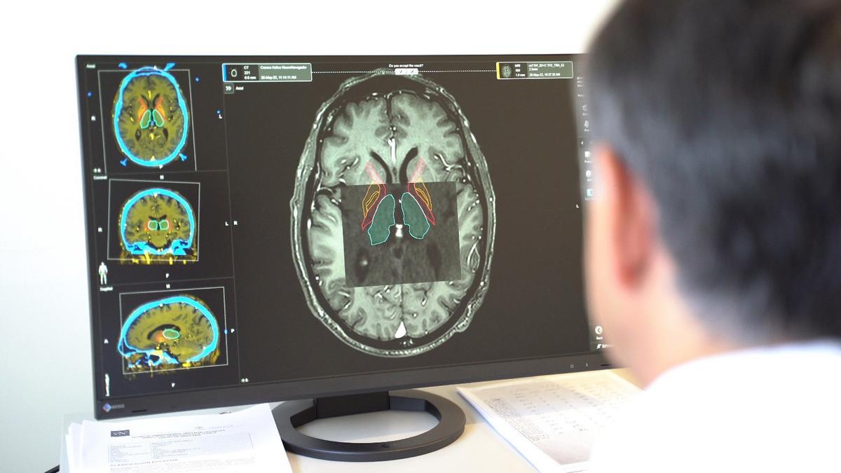 Terapias avanzadas en el diagnóstico y tratamiento de parkinson.