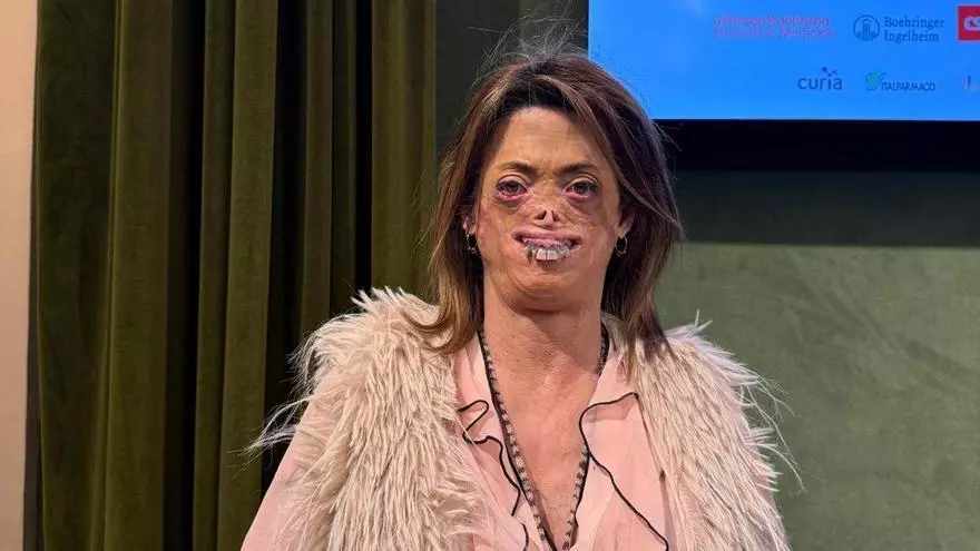 Fide Mirón, paciente de enfermedad rara: "Pido más investigación y acompañamiento porque no quiero que nadie pase por lo que yo he pasado"