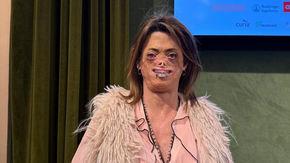 Fide Mirón, paciente de enfermedad rara: "Pido más investigación y acompañamiento porque no quiero que nadie pase por lo que yo he pasado"