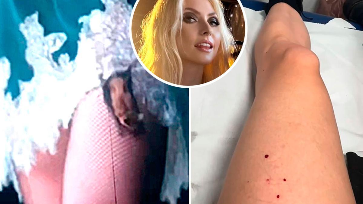 La pierna de Taylor Momsen con las mordeduras del murciélago.