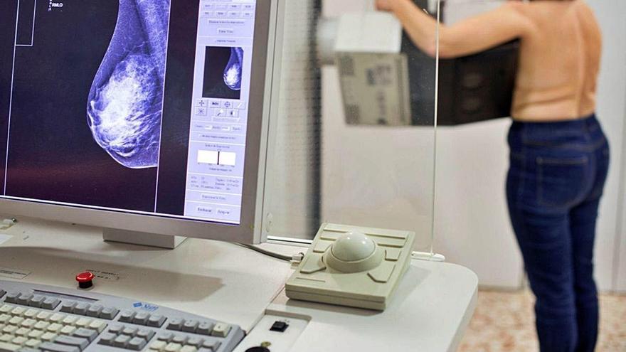 Les mamografies per a la detecció precoç dels tumors de pit tenen un 70% més de demora.