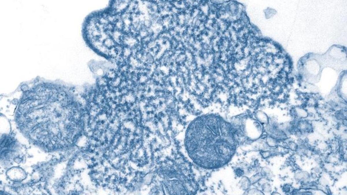 Así es el letal virus Nipah, que ha causado varios muertos en la India y pone en alerta a la OMS Así es el letal virus Nipah, que ha causado varios muertos en la India y pone en alerta a la OMS