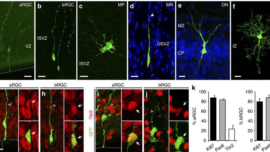 Hallan un nuevo proceso celular en una fase del desarrollo de corteza cerebral