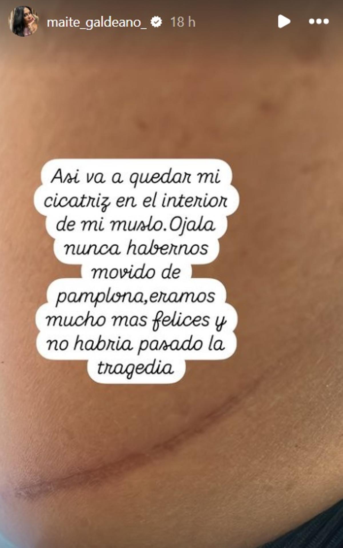 La cicatriz de Maite Galdeano