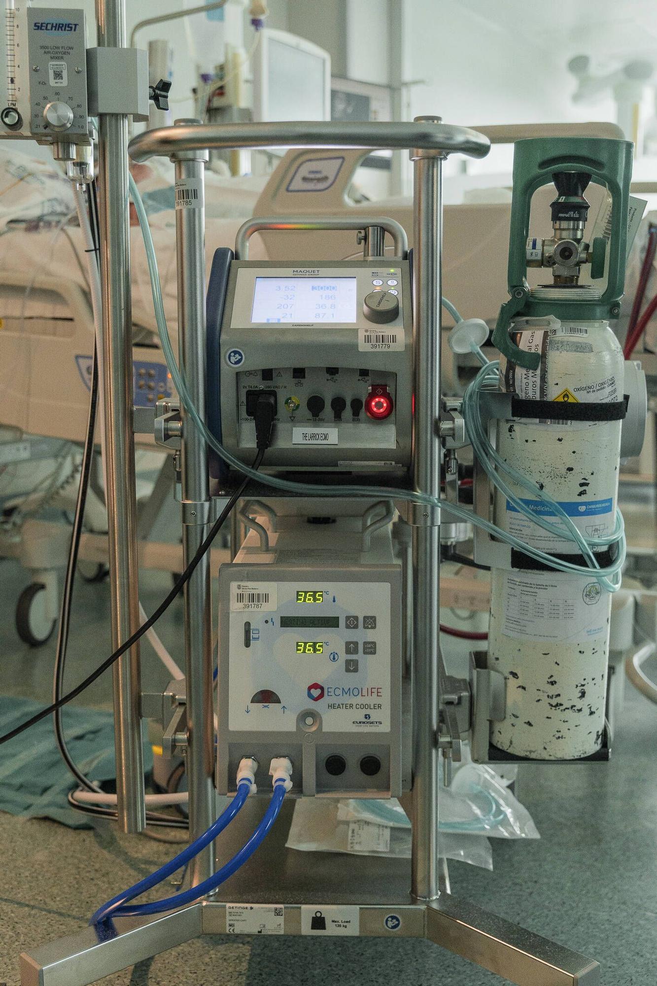 Brite berlebt Covid auf Mallorca  und spendet lebensrettendes ECMO-Gert