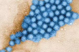 Qué es el contagioso norovirus que ha provocado un brote de 144 casos en Almería