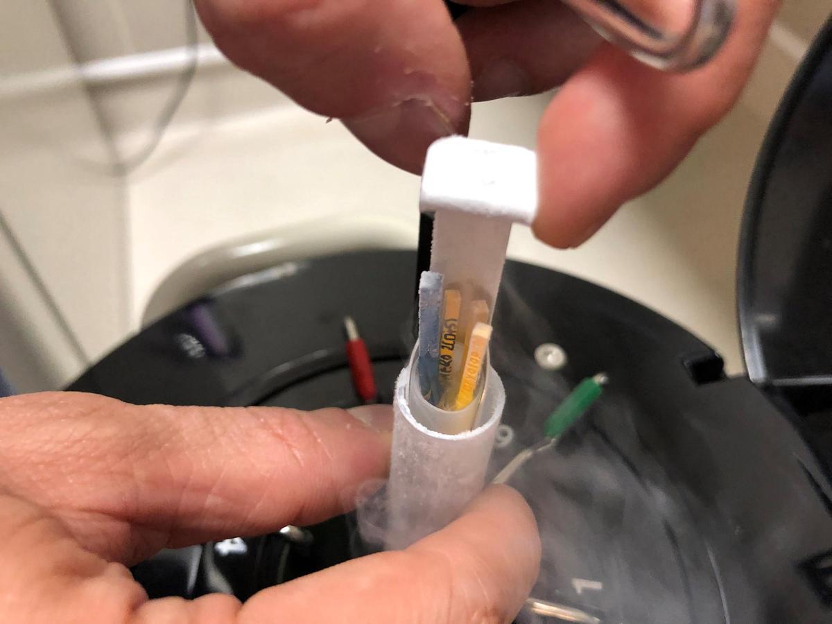 Un estudio constata un descenso de la edad de congelación de óvulos de 38 a 35 años