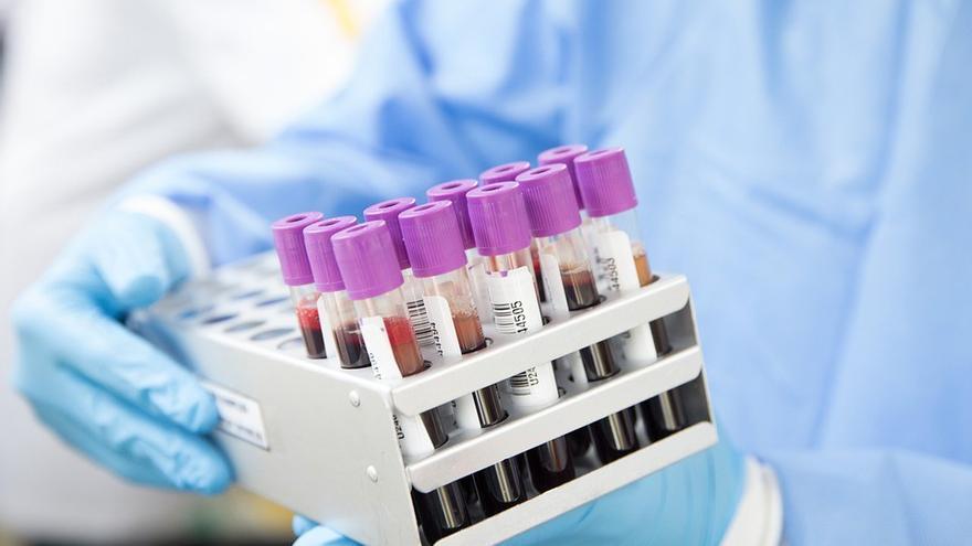 Logran curar a una mujer del VIH gracias a células madre de sangre de cordón umbilical