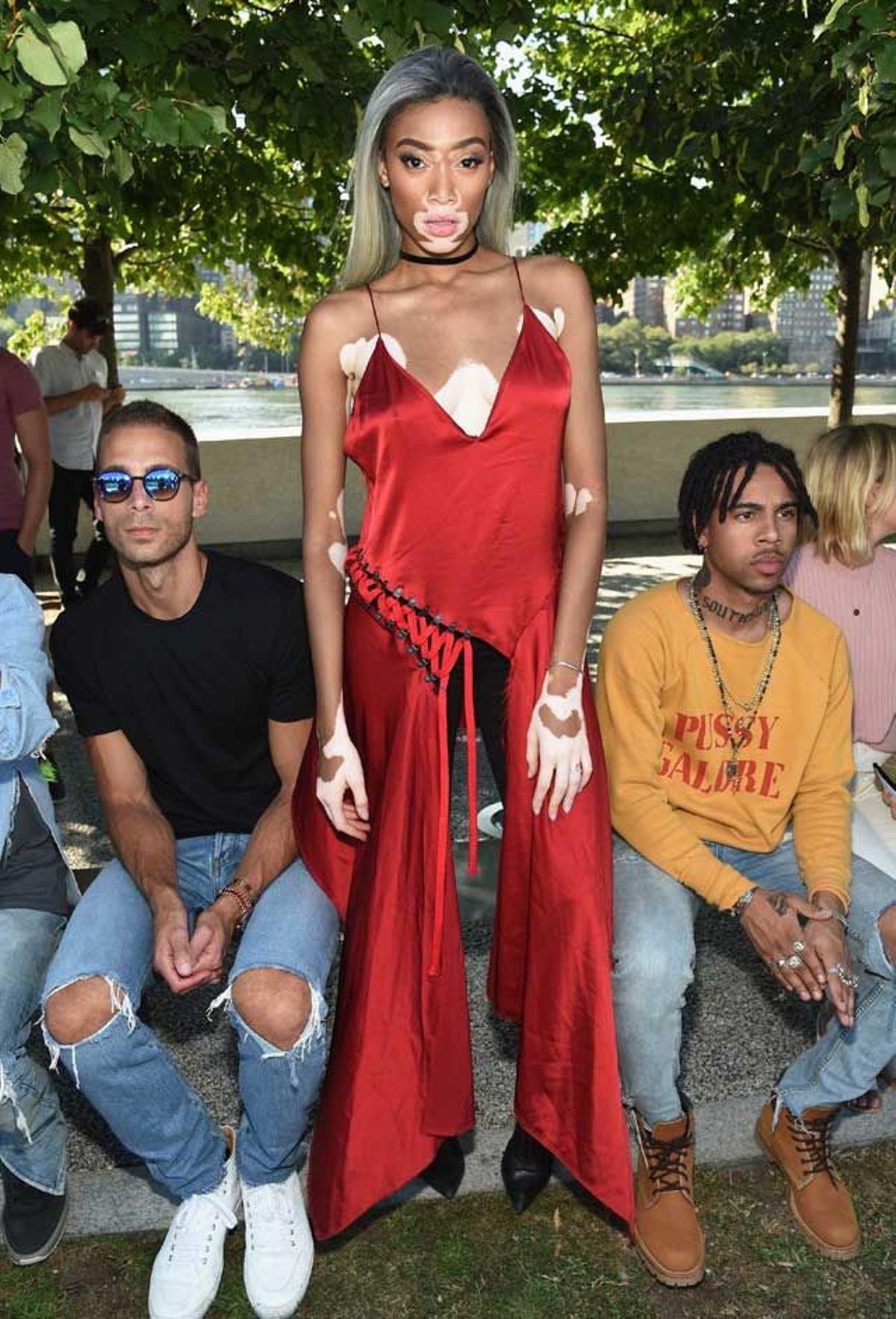 Winnie Harlow en el desfile Yeezy de Kanye West.