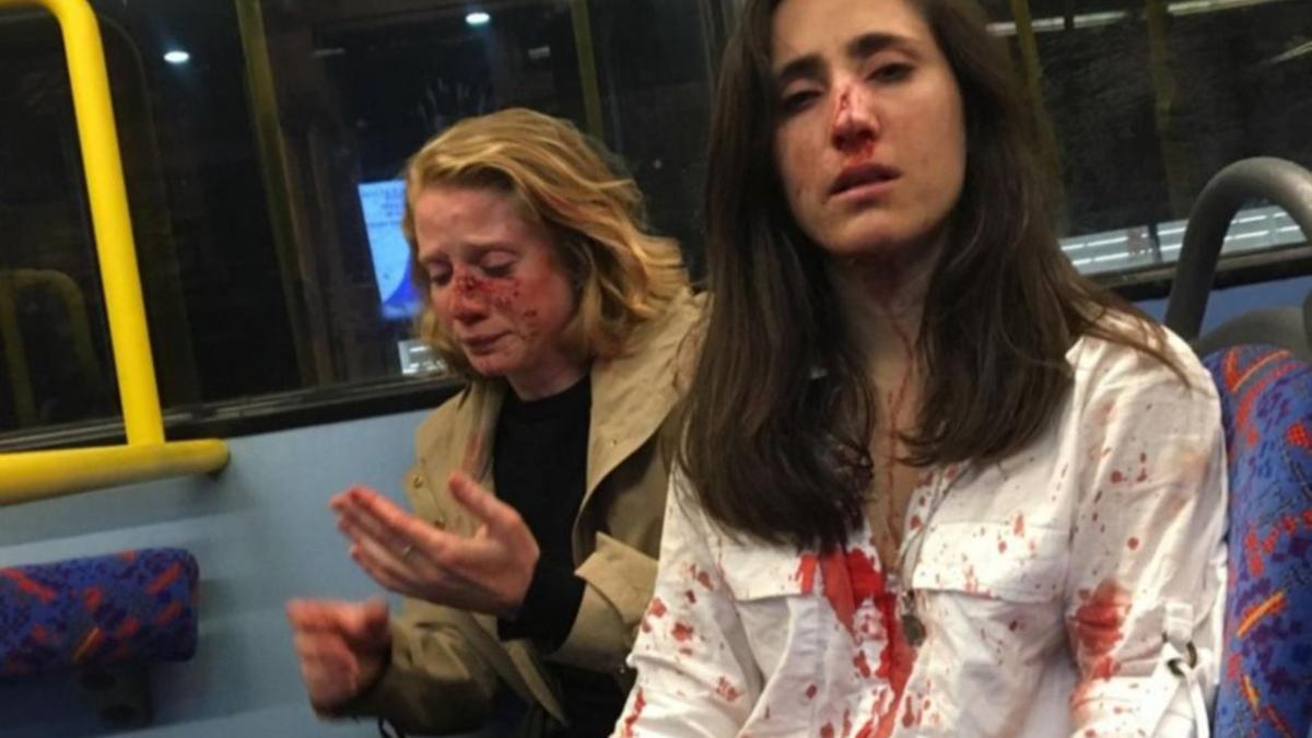 Melania Geymonat y su pareja, tras ser agredidas en un autobús en Londres