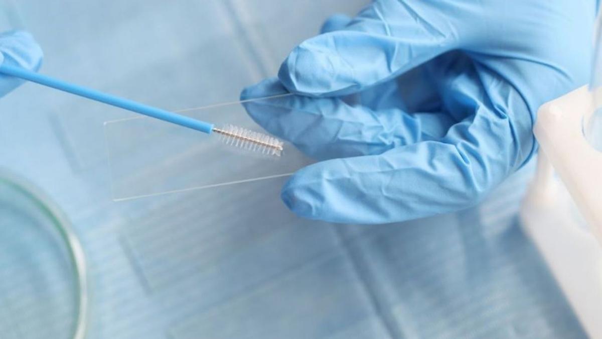 Pruebas de detección de cáncer de cuello uterino.