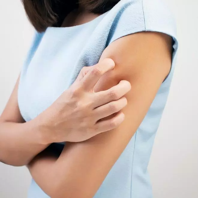 Parestesia, el nuevo efecto secundario de la vacuna de Moderna con decenas de afectados